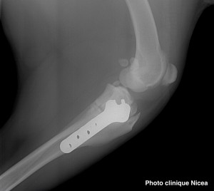 rupture ligament croisé - TPLO