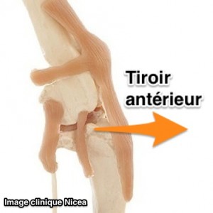 rupture du ligament croisé du chien - tiroir antérieur